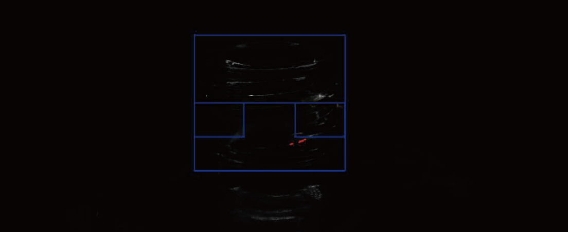Horizontal Crack Detection